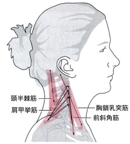 肩こりを防ぐ首の位置を保つ筋肉！！～ひそかに作用する頭・頸長筋～
